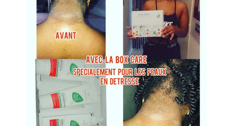 Réparer ma peau agréssée