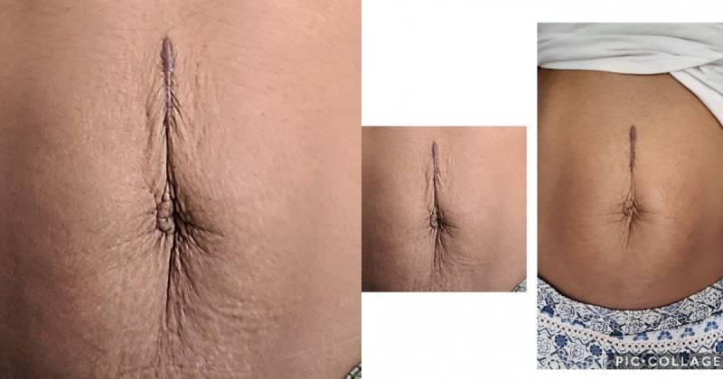 comment avoir un ventre plat 